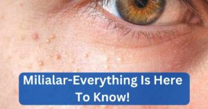 Milialar-Everything Is Here To Know! 