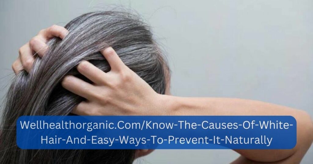 Wellhealthorganic.Com/Know-The-Causes-Of-White-Hair-And-Easy-Ways-To-Prevent-It-Naturally